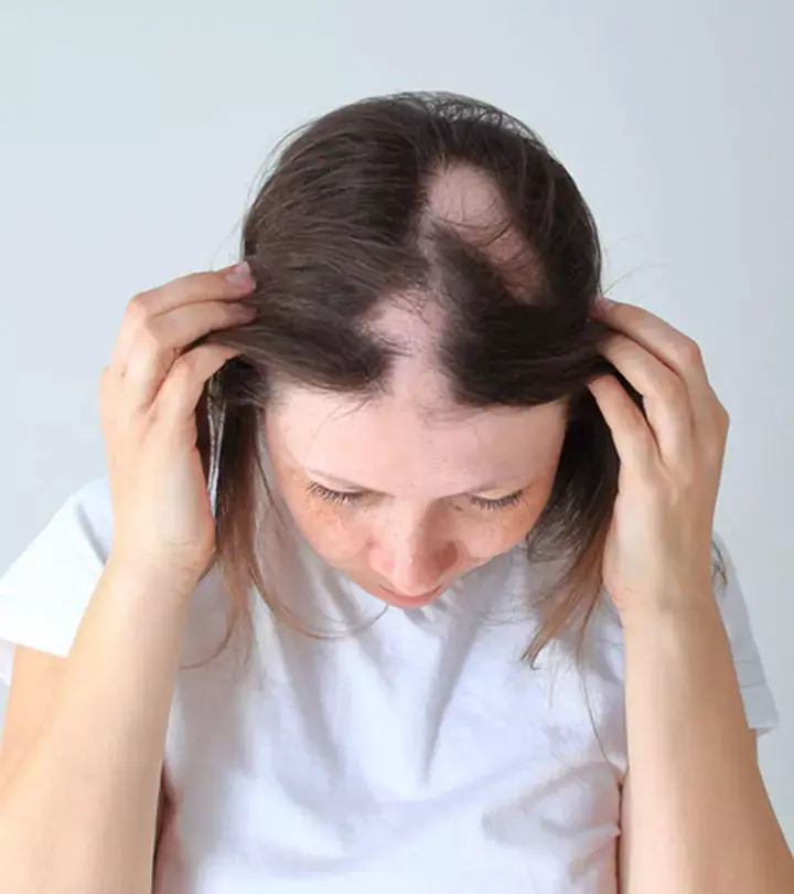 Hair Loss Treatment - Homoeopathic Treatment by Dr. Varadalakshmi Hair Loss Treatment